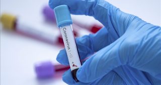 U BiH 733 nova slučaja zaraze koronavirusom, preminulo 39 osoba