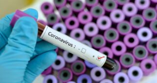 U Živinicama koronavirusom zaraženo 25 osoba