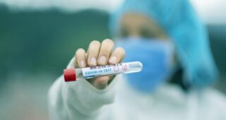 U Crnoj Gori 400 novih slučajeva koronavirusa